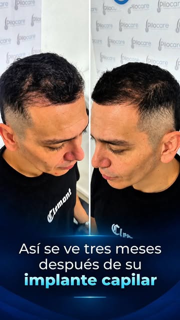 Tres meses y el cambio ya se empieza a sentir. 💙

Brayan llegó a PiloCare Pereira buscando recupera