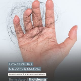 How much hair shedding is normal?

It is normal to lose between 50-150 hairs per day, when brushing,