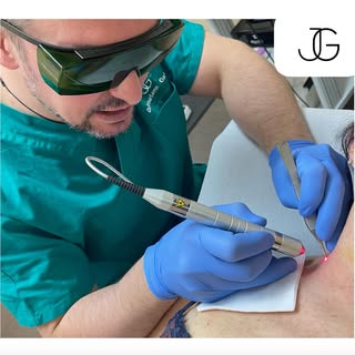 Rimozione di neoformazioni indolore e senza cicatrici con laser ablativo