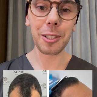 Só leia a legenda se você também sente que as entradas no cabelo…

As entradas são um dos primeiros 