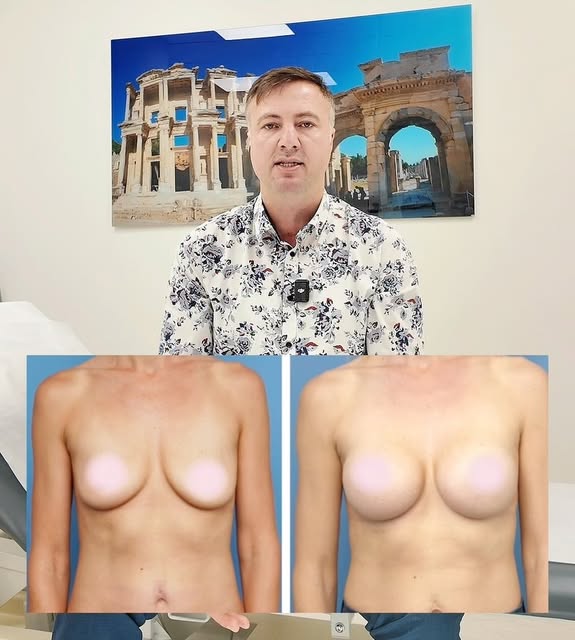 Dr Yaprak plans every augmentation around your frame and breast bays - not a fixed cup size. That me
