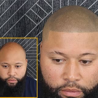 Barber Shop Edge Up! Any hairline you want, we can do. 

Scalp Micropigmentation offers guaranteed r