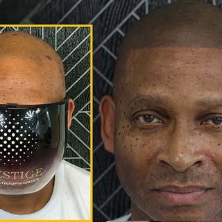 Edge Up SMP > Hair Transplants? 💯

A clean edge up can completely redefine your look—without surger