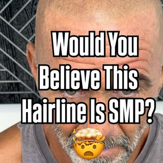 Natural hairline restoration is about more than just changing your appearance—it’s about bringing ba