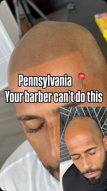 Your barber can sharpen your hairline—but what happens when there’s no hair left to cut? Scalp micro