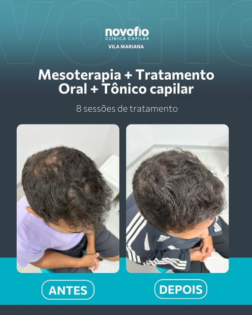 O resultado de um tratamento capilar bem indicado aparece nos detalhes: mais densidade, fios mais en