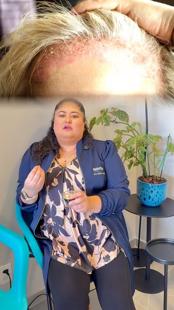 Caspa ou dermatite seborreica? Você sabe identificar a diferença? 👀

Embora ambas provoquem descama