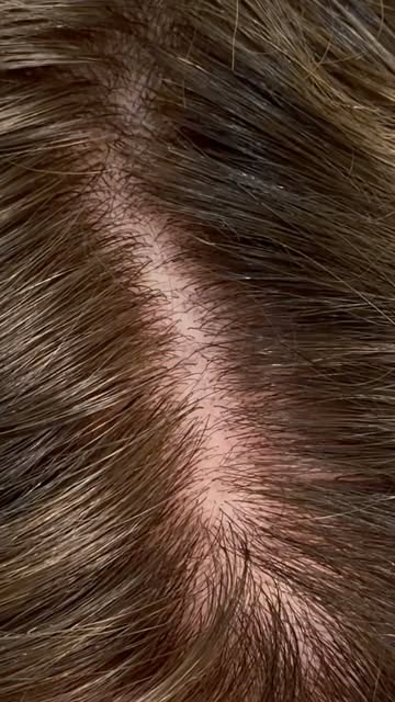 This is a DIFFERENT kind that I haven’t shown yet. It’s a scalp replica where the hair is made to lo