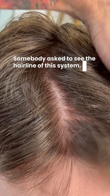 This systems downside is the thickness of the base to anchor the hair in. The upside is it literally