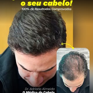 Quando o resultado transforma a autoestima. 
O antes e depois mostra mais do que uma mudança na apar