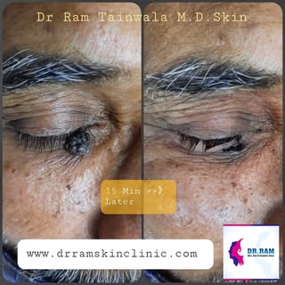 5 𝐑𝐄𝐀𝐒𝐎𝐍𝐒 𝐓𝐎 𝐕𝐈𝐒𝐈𝐓 𝐀 𝐃𝐄𝐑𝐌𝐀𝐓𝐎𝐋𝐎𝐆𝐈𝐒𝐓 𝐅𝐎𝐑 𝐌𝐎𝐋𝐄/𝐒𝐊𝐈𝐍 𝐓𝐀𝐆 𝐑𝐄�