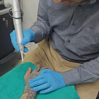 Precision meets performance. Advanced laser technology targeting unwanted tattoo pigments safely and