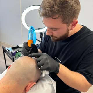 Regain your confidence. ✨ Scalp Micropigmentation (SMP) offers a non-surgical solution for hair loss