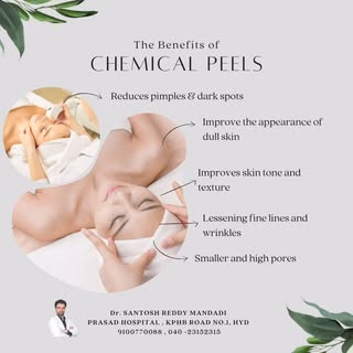 A chemical peel is a medical treatment that involves applying a chemical solution to the skin, which