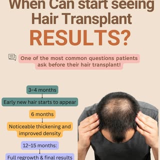 📅 WHEN WILL I SEE MY HAIR TRANSPLANT RESULTS?
That’s the #1 question most patients ask before their