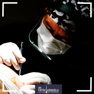 Dr. Fatih Köroğlu is a specialist skilled in the art and science of hair restoration, dedicated to h