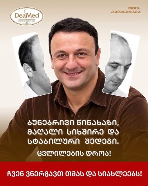 ცვლილების დროა❗️

#დეამედი #კლინიკადეამედი #24წლიანიგამოცდილება #hairtransplant #hairtransformation
