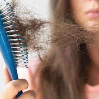 #minoxidil #hairfall #hairlosssolution #haircare #hairgrowth #hairlosstreatment