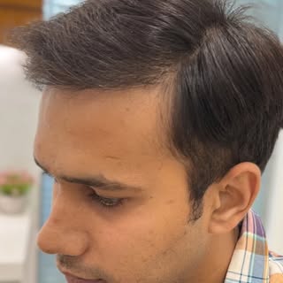 Outbloom Clinics is the best place for hair transplant in India using advanced FUE technique. Dr Akl