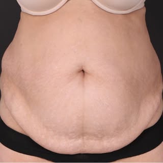 An interesting transformation story…

A young woman came to me with a simple wish — to look fitter, 