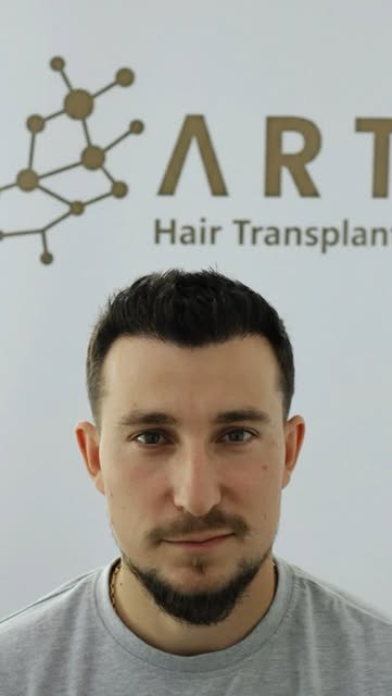 ✨ BEFORE & AFTER ✨

Uneori, diferența stă în detalii. 🤍
De la „înainte” la „după” — o transformare 