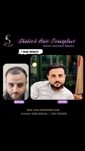 **12 Months. One Transformation. ✨**

The difference isn’t just in the hair —
**it’s in the confiden
