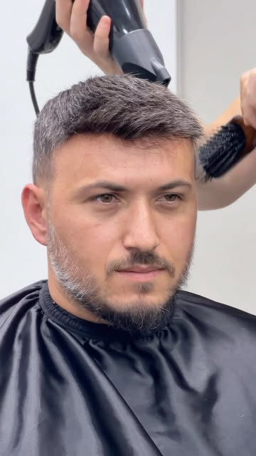 Protez saç değişimlerine gelen yorumlarınızı şarkı yapmayı seviyoruz:) #protezsaç #yorumlar #özgüven
