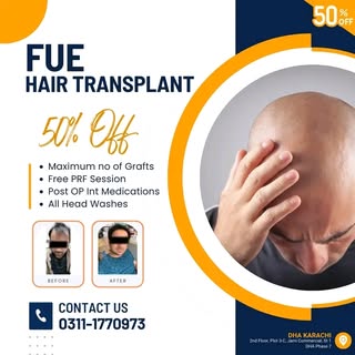 ⭕Special Discount -

✅Natural Looking Results (FUE) done with No Cuts, No Stitches, No Scars and alm