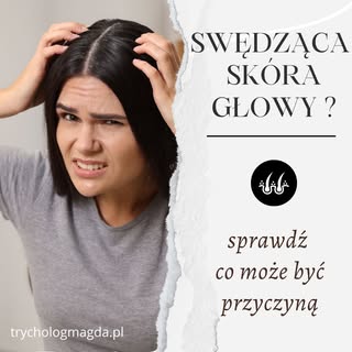 Swędzi Cię skóra głowy i nie wiesz dlaczego? Sprawdź możliwe przyczyny! 🤯
Uporczywe swędzenie skóry