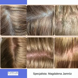 Piękny efekt pracy Specjslisty  z problemami  Celltilab 💙
Trycholog  Magdalena Jamróz 
@trychologma