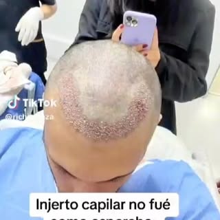 Les comparto la grabación de un paciente que nos mandó su video!!!!!!!!!!!! 😧😧😧😧😧. 👍🏻👍🏻👍🏻