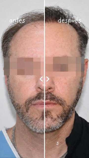 En KBAPEL estudiamos cada caso de forma personalizada para encontrar la alternativa adecuada para ti