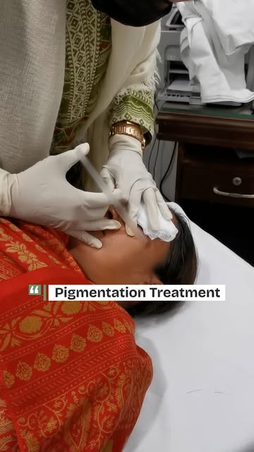 Pigmentation Treatment — Performed by Dr
#reelsviralシ #PigmentationTreatment #viralreelsシ