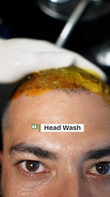 Headwash ASMR after hair transplant.
#head #asmr