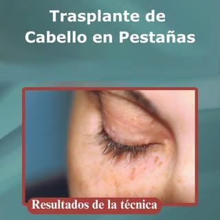 ¡Descubre el secreto de unas pestañas naturales y espectaculares! 👁 🌿 

El procedimiento es seguro