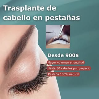 Con nuestro trasplante de pestañas, injertamos hasta 80 cabellos por párpado, logrando un resultado 