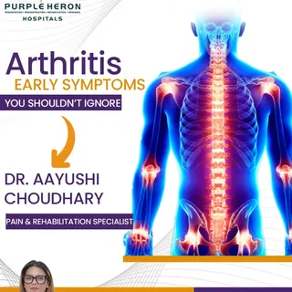 🦴 Arthritis: Early Symptoms You Shouldn’t Ignore
Arthritis is one of the most common causes of join