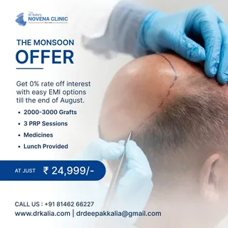 Monsoon Offer on Hair Transplant !
https://drkalia.com/

.
.
.

#hairtreatment #Hairtransplantrepair