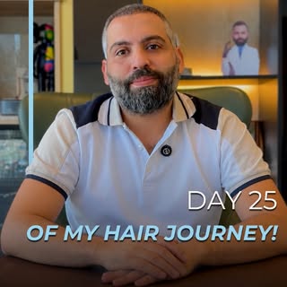 Day 25 after a hair transplant — and the shedding phase has officially started.

This is a normal pa