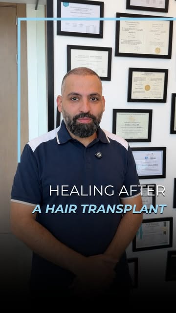 Hair transplant recovery is a gradual process, and every stage of healing matters. Following the rec