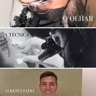 Olhar. A Técnica. O Resultado. ⚜️

O sucesso absoluto de um transplante capilar não é obra do acaso.