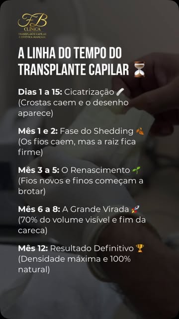 Já salva esse Reels para consultar sempre que a ansiedade bater! 📌⚜️

O transplante capilar não é m