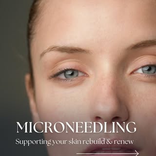 Everyone’s talking about microneedling right now… but not all of it is good advice.

A lot of what y