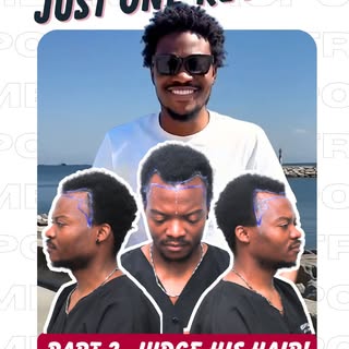 “Judge my hair.” 😎

Challenge accepted.

His only regret? Not having his hair transplant sooner.

T