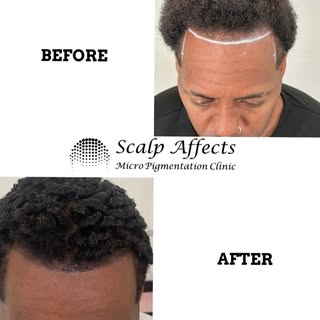 Getting insight from a barber I did a hairline  adjustment on only made my skills better.😎

Steal S