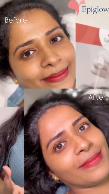 Some clients walk into Epiglow and instantly make the whole place more fun 😂❤️

Madhumita is defini