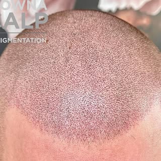 Final session for this gentleman… a little background for the before picture. 
He had been wearing a
