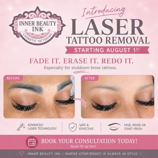 Laser tattoo removal has arrived! Book your consultation today!