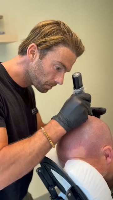 Full head with micro hair pigmentation after 14 years of alopecia!👌🚀

It’s always special to see w