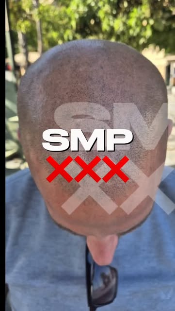 Bad SMP ❌❌️→ Removal by me → New SMP by me 🎯

@folicule pigment🔥